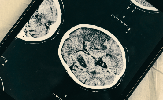 Your Brain on Nature: Nourishing Neurological Health with Herbs, Foods & Rituals